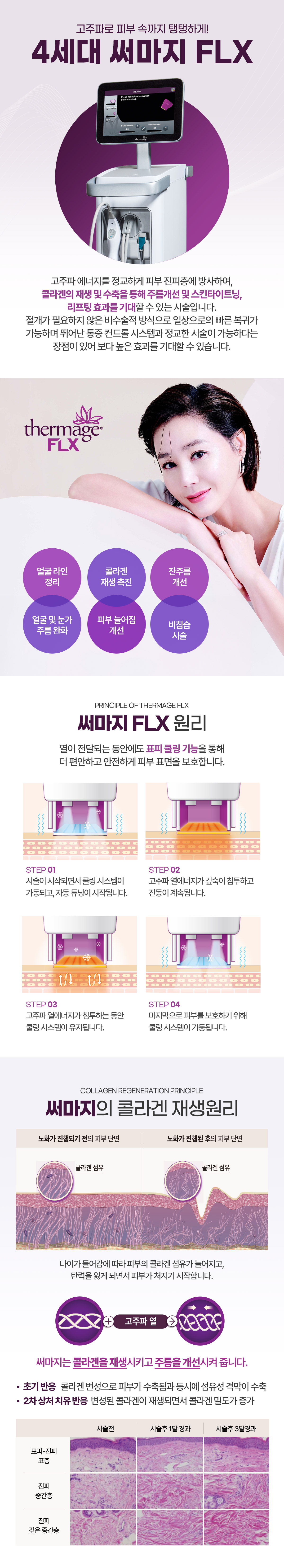 써마지 FLX